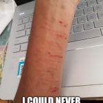 Loser | I COULD NEVER CUT MYSELF ENOUGH | image tagged in loser filth | made w/ Imgflip meme maker
