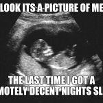 Ultrasound babby | LOOK ITS A PICTURE OF ME; THE LAST TIME I GOT A REMOTELY DECENT NIGHTS SLEEP | image tagged in ultrasound babby | made w/ Imgflip meme maker