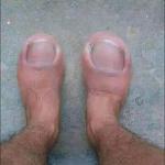 Big toe