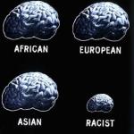 Brain comparison