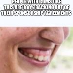 big gums | PEOPLE WITH GUMS LIKE THIS ARE 100% BACKING OUT OF THEIR SPONSORSHIP AGREEMENTS | image tagged in big gums | made w/ Imgflip meme maker