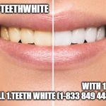 Looking For a New Dentist In Mosman | WITHOUT  1-TEETHWHITE; WITH 1.TEETH WHITE

CALL 1.TEETH WHITE (1-833 849 4483) | image tagged in looking for a new dentist in mosman | made w/ Imgflip meme maker