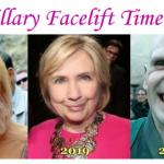 Hillary Facelift Timeline