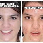 Am I the only one who this happens to? | WASHES FACE TWICE A DAY; WASHES FACE EVERY OTHER DAY WHEN SHOWERING | image tagged in before and after acne meme | made w/ Imgflip meme maker
