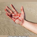 Self Applied First-Aid for a Diabetic | YOU KNOW YOU’RE DIABETIC WHEN; YOUR FIRST INSTINCT IN ASSESSING A BLEEDING INJURY IS TO CHECK GLUCOSE TO SAVE A FINGER STICK | image tagged in bloody hand,first aid,blood,bleeding,glucose,finger stick | made w/ Imgflip meme maker