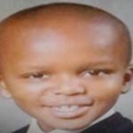 forhead