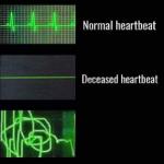 Heartbeat