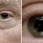 Trump eyes dilated, close and closer
