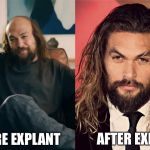 AFTER EXPLANT; BEFORE EXPLANT | image tagged in memes | made w/ Imgflip meme maker