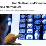 No Brain, Normal Life