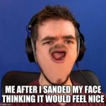OH MAAAAAAAAN - Jacksepticeye | ME AFTER I SANDED MY FACE THINKING IT WOULD FEEL NICE | image tagged in oh maaaaaaaan - jacksepticeye | made w/ Imgflip meme maker