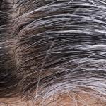 Gray hair roots