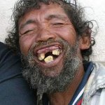 Guy with bad teeth