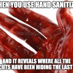 Hand pain | WHEN YOU USE HAND SANITIZER; AND IT REVEALS WHERE ALL THE PAPER CUTS HAVE BEEN HIDING THE LAST MONTH | image tagged in hand pain | made w/ Imgflip meme maker