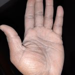 A health care workers hand after a hard days work.