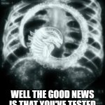 Testing Negative for COVID-19 | WELL THE GOOD NEWS IS THAT YOU'VE TESTED NEGATIVE FOR COVID-19 | image tagged in alien xray,covid-19,coronavirus,funny memes,funny | made w/ Imgflip meme maker