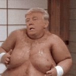 Trump United States President Morbidly Obese