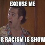 Ace Ventura Pet Detective Yelling | EXCUSE ME; YOUR RACISM IS SHOWING | image tagged in ace ventura pet detective yelling | made w/ Imgflip meme maker