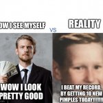 Big Oof | REALITY; HOW I SEE MYSELF; WOW I LOOK PRETTY GOOD; I BEAT MY RECORD, BY GETTING 10 NEW PIMPLES TODAY!!!!!!! | image tagged in expectations gone down,relatable,funny memes | made w/ Imgflip meme maker