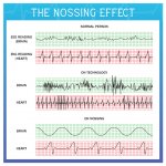 Nossing Effect