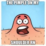 cant even explain how annoying this is | THE PIMPLE ON MY; SHOULDER RN | image tagged in pimple | made w/ Imgflip meme maker