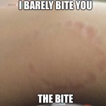 Come on | I BARELY BITE YOU; THE BITE | image tagged in come on | made w/ Imgflip meme maker