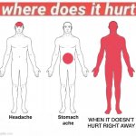 Where does it hurt | WHEN IT DOESN’T HURT RIGHT AWAY | image tagged in where does it hurt | made w/ Imgflip meme maker