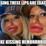 Yikes | KISSING THESE LIPS ARE EXACTLY LIKE KISSING HEMORRHOIDS | image tagged in memes,duck face chicks,funny,scary,fun | made w/ Imgflip meme maker