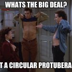 Circular protuberance | WHATS THE BIG DEAL? JUST A CIRCULAR PROTUBERANCE | image tagged in circular protuberance | made w/ Imgflip meme maker