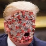 Trump's virus
