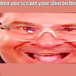 When you scrape your shin | When you scrape your shin on brick | image tagged in deep fried phil swift,phil swift,thats a lot of damage,ouch | made w/ Imgflip meme maker