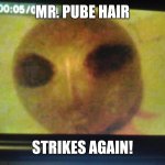 Guess Who??  XD | MR. PUBE HAIR; STRIKES AGAIN! | image tagged in mr pube hair,xd,lol,funny,mr pube hair strikes again,yeet boi | made w/ Imgflip meme maker