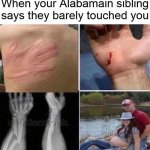 Alabamain Sibling Says He Barely Touched You