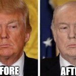 Trump Skin | BEFORE; AFTER | image tagged in trump skin | made w/ Imgflip meme maker