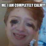 I AM COMPLETELY CALM | MY FRIEND: YOU SERIOUSLY NEED TO CALM DOWN! ME: I AM COMPLETELY CALM!!! MY FACE: | image tagged in i am calm | made w/ Imgflip meme maker