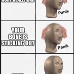 Haha meme man spooktober | YOU FALL AND GET HURT REALLY BAD; YOUR BONE IS STICKING OUT; YOUR EXTRA SPOOKY | image tagged in panik panik kalm,spooktober | made w/ Imgflip meme maker