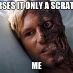 Two Face | NURSES IT ONLY A SCRATCH; ME | image tagged in two face | made w/ Imgflip meme maker