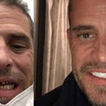 Hunter Biden meth mouth before and after