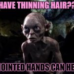 Have thinning hair? | HAVE THINNING HAIR?? ANOINTED HANDS CAN HELP. | image tagged in smegalll | made w/ Imgflip meme maker