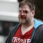 trump supporter bleeding