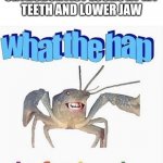 What the hap is fuckening | WHEN THE ORTHODONTIST LOOKS AT MY TEETH AND LOWER JAW | image tagged in what the hap is fuckening | made w/ Imgflip meme maker