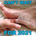 foot skin peel shedding | CAN'T WAIT; FOR 2021 | image tagged in foot skin peel shedding,feet,grossed out,2021 | made w/ Imgflip meme maker