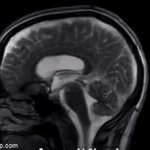 EW!!! | EW! THIS IS HUMONS BRAIN. LOL! | image tagged in gifs,brain | made w/ Imgflip video-to-gif maker