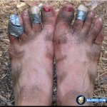 Ugly feet