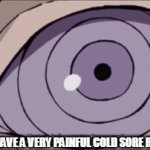 owch.. | ME RN ( I HAVE A VERY PAINFUL COLD SORE R . I . P ME ) | image tagged in gifs,pain,sad,ouch | made w/ Imgflip video-to-gif maker