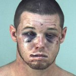 Mug shot Beaten up guy