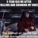 The attempt on my life has left me scarred and deformed | 5 YEAR OLD ME AFTER FALLLING AND SKINNING MY KNEE: | image tagged in the attempt on my life has left me scarred and deformed | made w/ Imgflip meme maker