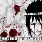 Crying Sasuke | ME AFTER GETTING WHOOPED; PARENTS:WHERE’D THOSE BRUISES AND CUTS COME FROM | image tagged in crying sasuke | made w/ Imgflip meme maker