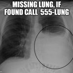 Missing | MISSING LUNG, IF FOUND CALL  555-LUNG | image tagged in missing | made w/ Imgflip meme maker