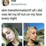 Skin transformation